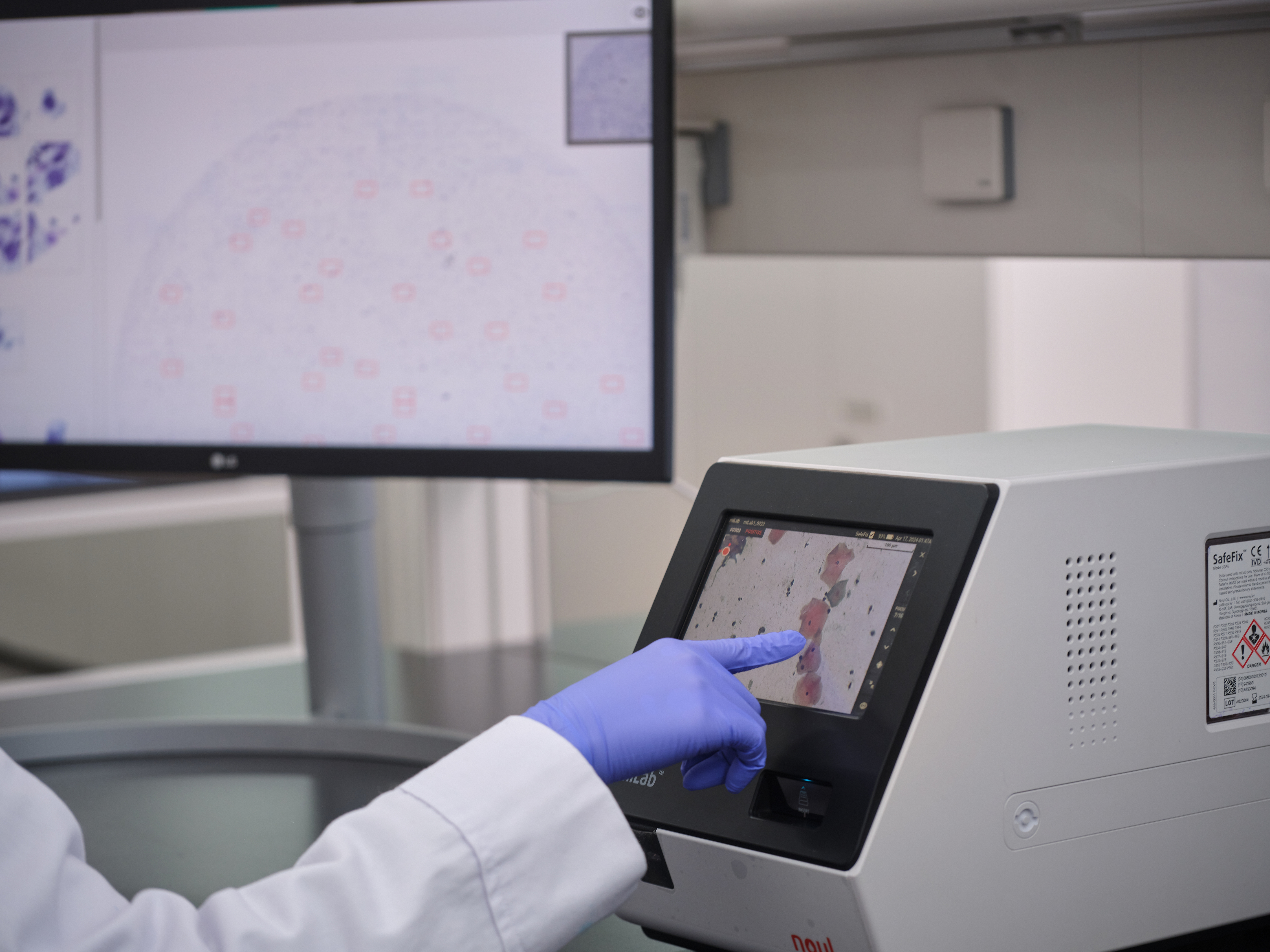 miLab™ CER expansion in Europe