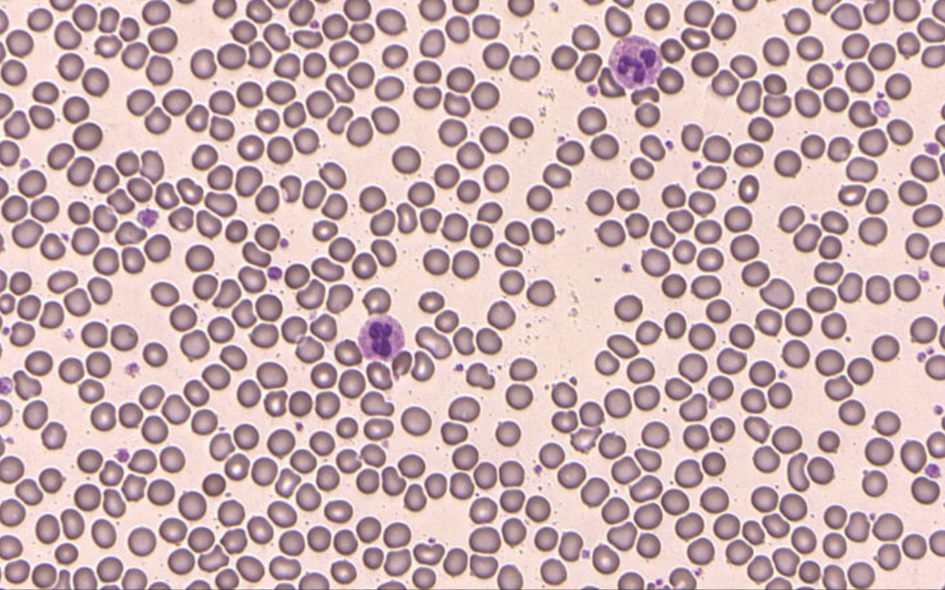 Blood Cell Morphology